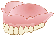 総入れ歯 （総義歯）